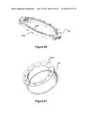 Device Delivery System diagram and image