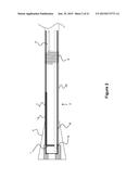 Catheter System diagram and image