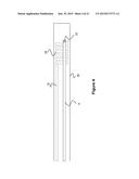 Catheter System diagram and image