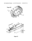 Catheter System diagram and image