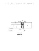 Catheter System diagram and image