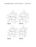 BONE SIZING GUIDE diagram and image