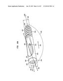 Fixation System, An Intramedullary Fixation Assembly and Method of Use diagram and image