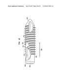 Fixation System, An Intramedullary Fixation Assembly and Method of Use diagram and image