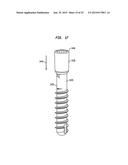 Fixation System, An Intramedullary Fixation Assembly and Method of Use diagram and image