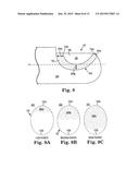 ELECTROSURGICAL CUTTING INSTRUMENT diagram and image