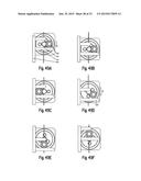 Surgical Instrument Arrangement And Drive Train Arrangement For A Surgical     Instrument, In Particular A Robot-Guided Surgical Instrument, And     Surgical Instrument diagram and image