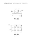 VAGINAL INSERT METHOD OF MANUFACTURE diagram and image