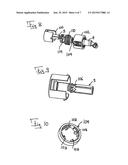 INCONTINENCE IMPLANT diagram and image