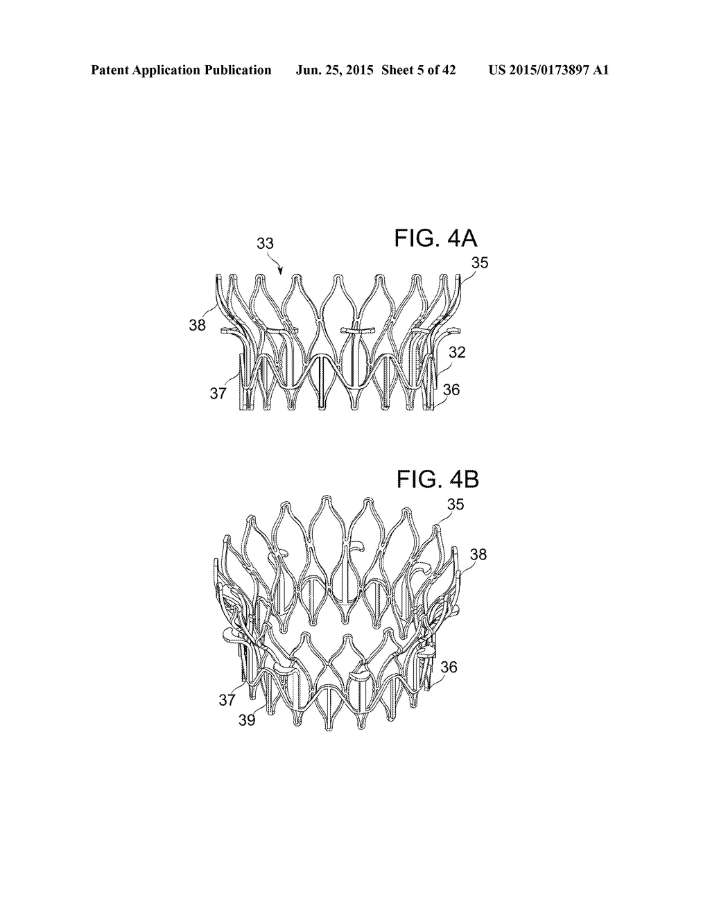 PROSTHETIC MITRAL VALVE - diagram, schematic, and image 06