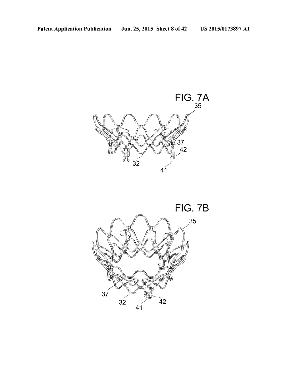 PROSTHETIC MITRAL VALVE - diagram, schematic, and image 09