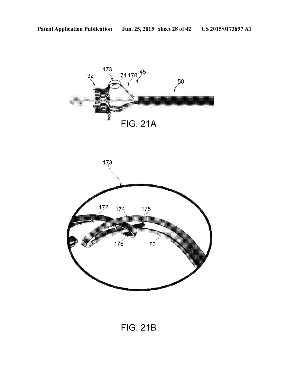 PROSTHETIC MITRAL VALVE - diagram, schematic, and image 29