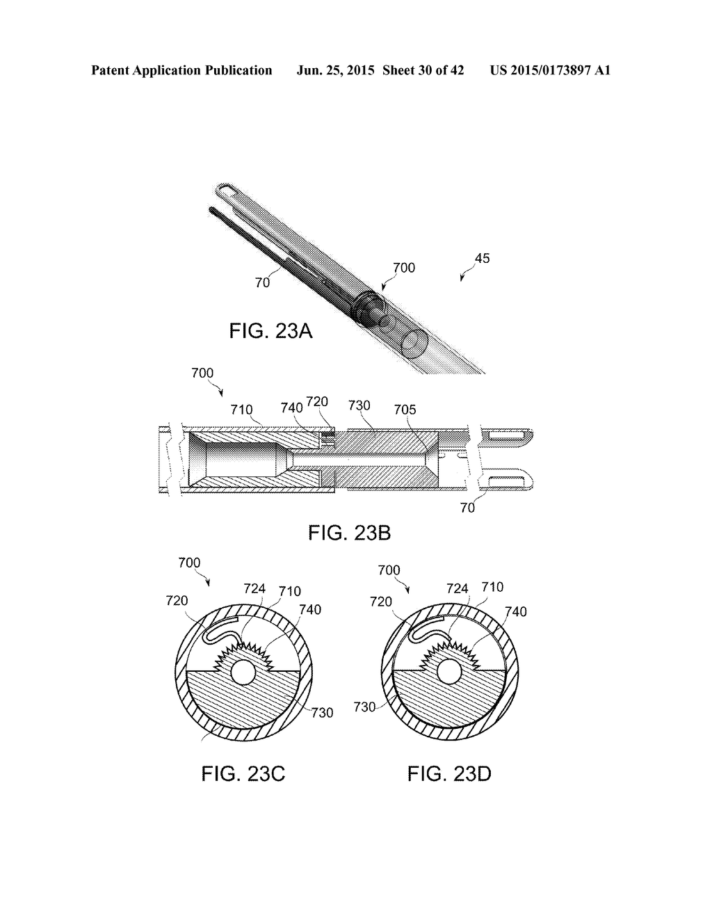 PROSTHETIC MITRAL VALVE - diagram, schematic, and image 31