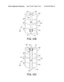 BONE IMPLANTS FOR ORTHOPEDIC PROCEDURES AND CORRESPONDING METHODS diagram and image