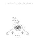 BONE IMPLANTS FOR ORTHOPEDIC PROCEDURES AND CORRESPONDING METHODS diagram and image