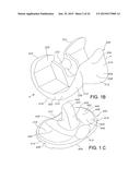 HIGH PERFORMANCE KNEE PROSTHESES diagram and image