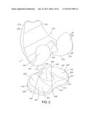 HIGH PERFORMANCE KNEE PROSTHESES diagram and image