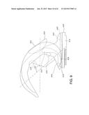 HIGH PERFORMANCE KNEE PROSTHESES diagram and image