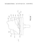 HIGH PERFORMANCE KNEE PROSTHESES diagram and image