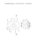 HIGH PERFORMANCE KNEE PROSTHESES diagram and image