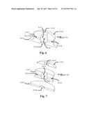 SHOCK ABSORBING, TOTAL DISC REPLACEMENT PROSTHETIC diagram and image