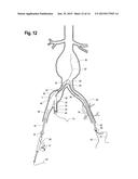 DELIVERY DEVICE WITH AN EXTENSION SHEATH AND METHODS OF USING THE SAME diagram and image