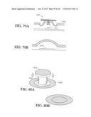 REDUCED PRESSURE APPARATUS AND METHODS diagram and image