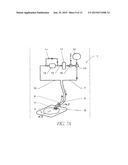 WOUND CLEANSING APPARATUS diagram and image