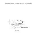 WOUND CLEANSING APPARATUS diagram and image