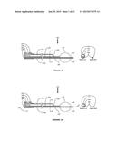 DEVICES AND METHODS FOR THE TREATMENT OF VASCULAR DISEASE diagram and image