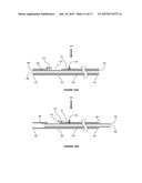 DEVICES AND METHODS FOR THE TREATMENT OF VASCULAR DISEASE diagram and image