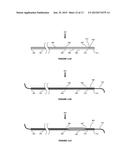 DEVICES AND METHODS FOR THE TREATMENT OF VASCULAR DISEASE diagram and image