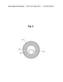 DEVICE FOR PROTECTING THE RECTAL ANASTOMOSIS diagram and image