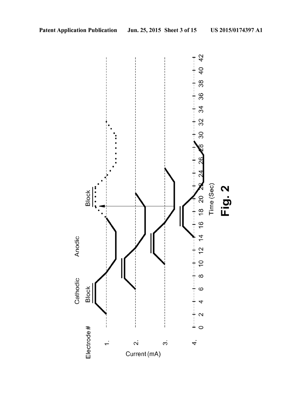 THERAPY DELIVERY DEVICES AND METHODS FOR NON-DAMAGING NEURAL TISSUE     CONDUCTION BLOCK - diagram, schematic, and image 04