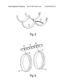 FLEXIBLE TURBOCHARGER AIR DUCT WITH CONSTRICTING RINGS diagram and image