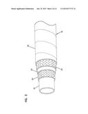 METHODS AND SYSTEMS FOR MEASURING HOSE RESISTANCE diagram and image