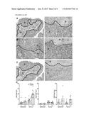 BIOMARKERS OF IMMUNE RESPONSE IN MUCOSAL LESIONS AND THEIR USE WITH     THERAPEUTIC VACCINATION diagram and image