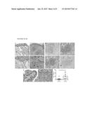 BIOMARKERS OF IMMUNE RESPONSE IN MUCOSAL LESIONS AND THEIR USE WITH     THERAPEUTIC VACCINATION diagram and image