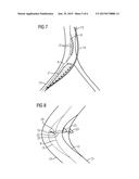 Image Monitoring During an Interventional Procedure, X-Ray Device,     Computer Program and Data Medium diagram and image