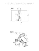 Image Monitoring During an Interventional Procedure, X-Ray Device,     Computer Program and Data Medium diagram and image