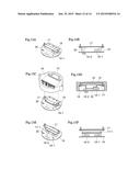 MOTOR DRIVE DEVICE FOR ELECTRIC POWER STEERING diagram and image