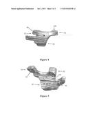 LOW PROFILE PATIENT SPECIFIC CUTTING BLOCKS FOR A KNEE JOINT diagram and image