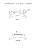 DENTAL COMPOSITIONS CONTAINING UPCONVERSION PHOSPHORS AND METHODS OF USE diagram and image