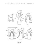 DENTAL COMPOSITIONS CONTAINING UPCONVERSION PHOSPHORS AND METHODS OF USE diagram and image