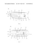 EXPANDABLE TISSUE SPACE IMPLANT AND METHOD OF USE diagram and image