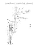 EXPANDABLE TISSUE SPACE IMPLANT AND METHOD OF USE diagram and image