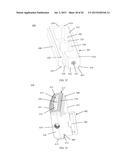 EXPANDABLE TISSUE SPACE IMPLANT AND METHOD OF USE diagram and image