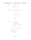 EXPANDABLE TISSUE SPACE IMPLANT AND METHOD OF USE diagram and image