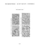 TISSUE ENGINEERING OF LUNG diagram and image