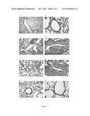 Vaccine for Prophylaxis or Treatment of an Allergen-Driven Airway     Pathology diagram and image